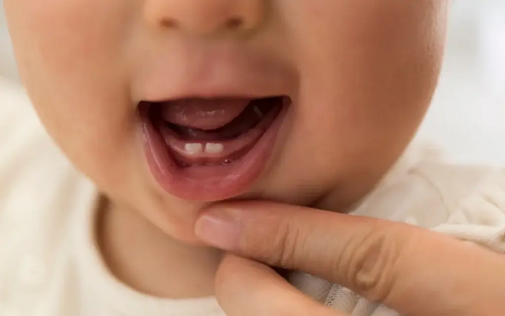 Preventing Dental Crowding and Social Challenges in Children